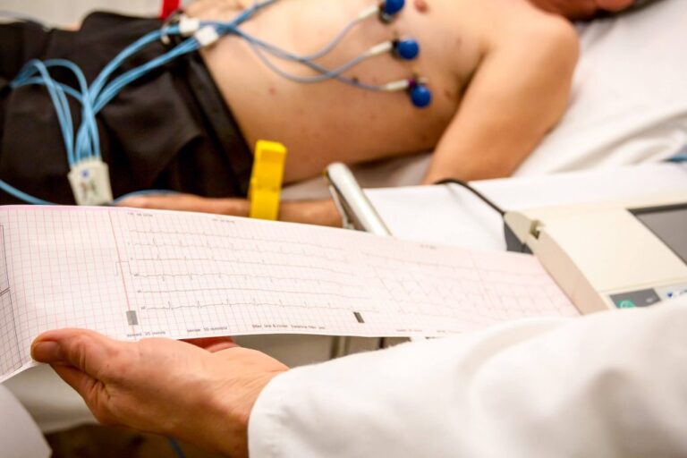 12-Lead Electrocardiogram (ECG)
