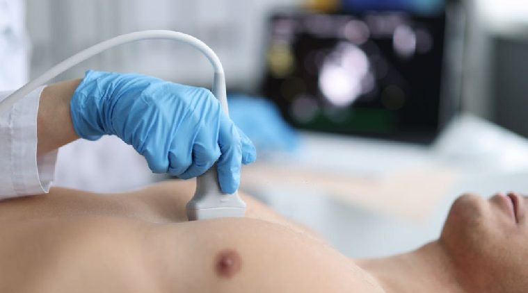 Echocardiography