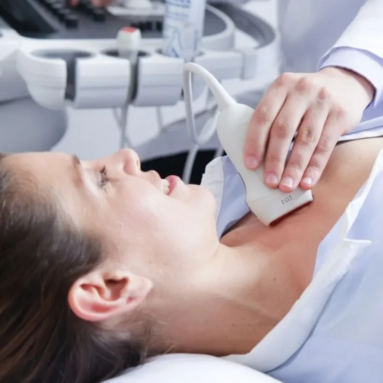 Carotid Ultrasound (CAD)