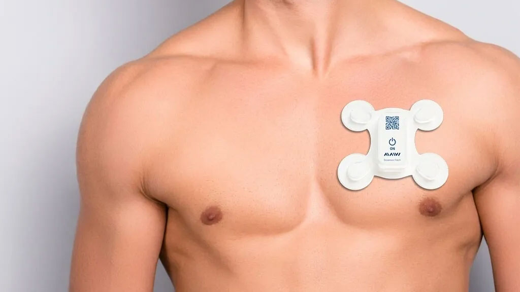 Ambulatory ECG Monitoring